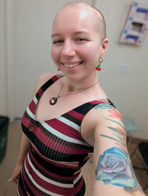 September is Alopecia Awareness Month! Patchy heads are beautiful too!