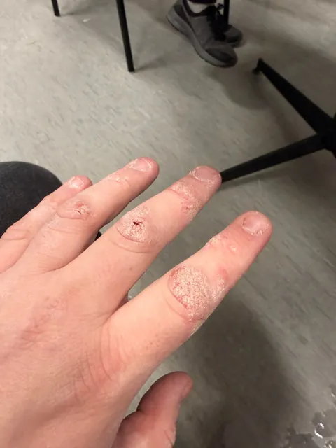 Dry Air + Constantly working with cardboard boxes