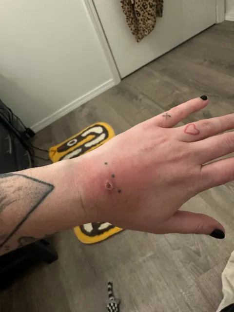 Four different doctors, a myriad of prescriptions, nonstop pain and nobody can figure out what this is.