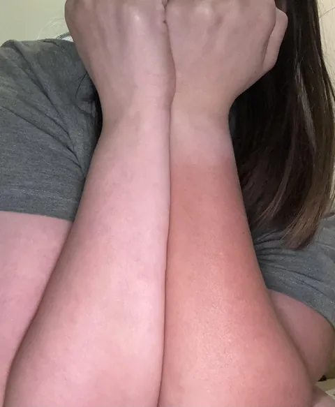 My arms are two different colors because of my commute.