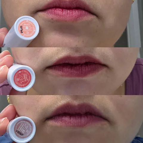 Don't waste your money on Wonderskin