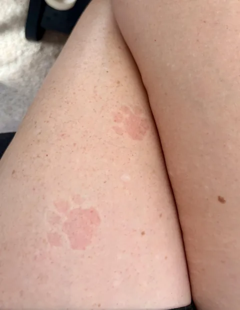 My cat likes to stand on my lap while I'm on calls and leaves these cute little pressure paw prints on my leg