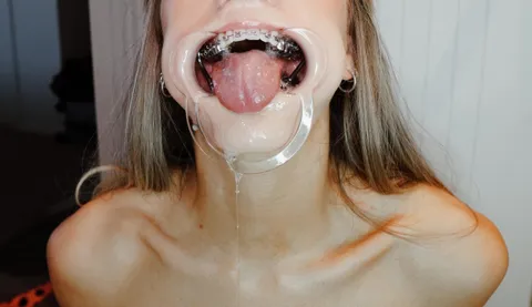 Things got a little out of hand at the dentist’s office