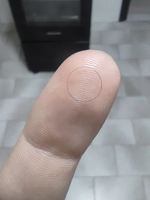 This single hair that coiled in a perfect circle