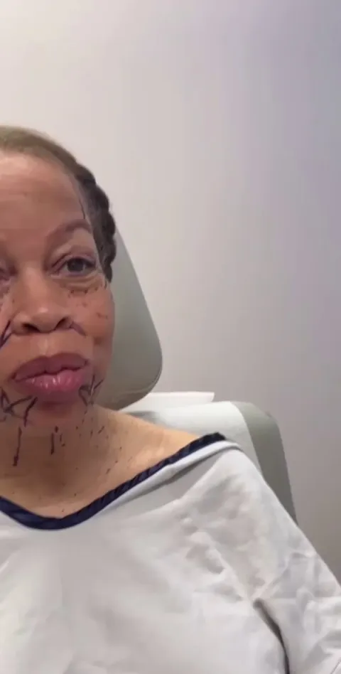 Good plastic surgeons are hard to come by!