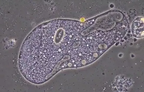 This is what happens to germs when you wash your hands with soap. If you get enough soap molecules into their lipid plasma membrane, they breaks it apart, destroying it.