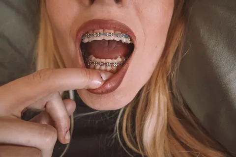 How ya like my blue and purple bands?