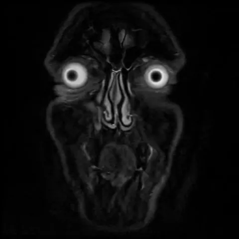 So I had an MRI last week and, kinda scary.