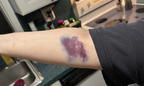 i just needed 1-2 vials of blood drawn…