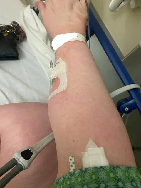 I was in the ER and called for a nurse multiple times about my IV being placed wrong. No one showed up until 45 min later and i stopped the IV myself already