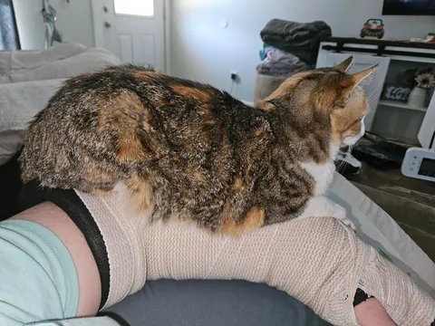 She wont leave my side since i shatteredcmy elbow