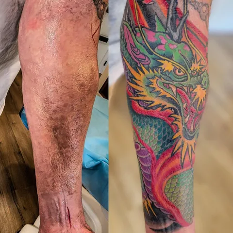 I Covered Some Gnarly 3rd Degree Burn Scars with a Fire Dragon by Adam Sky, Morningstar Tattoo, Belmont, California