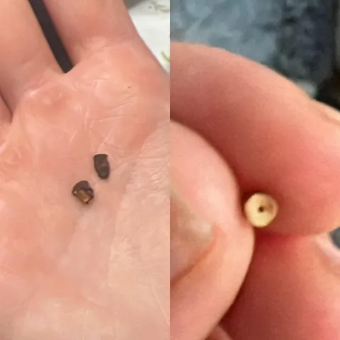 Painful hard wax was actually an earring backing