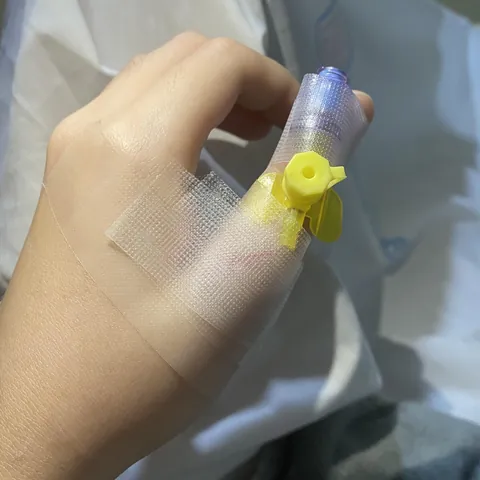 Had my gallbladder removed and ended up with an IV on the side of my thumb