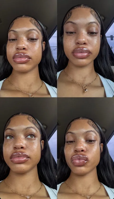 😮‍💨😮‍💨😮‍💨😮‍💨omg