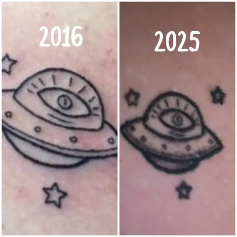 Before and after tattoos