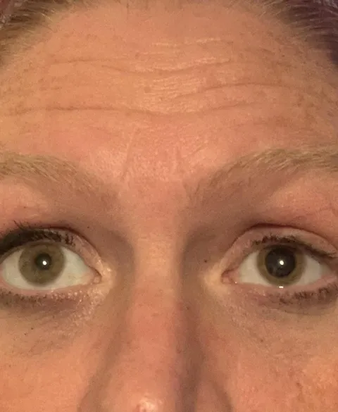 Noticed my pupils are two different sizes.