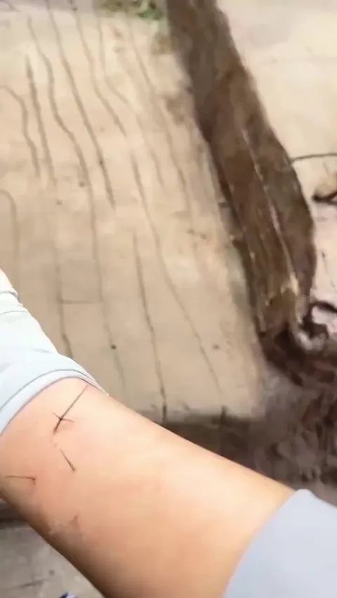 Zookeeper Got a Thorn... and the Monkey Became the Doctor 🐒🩹💛