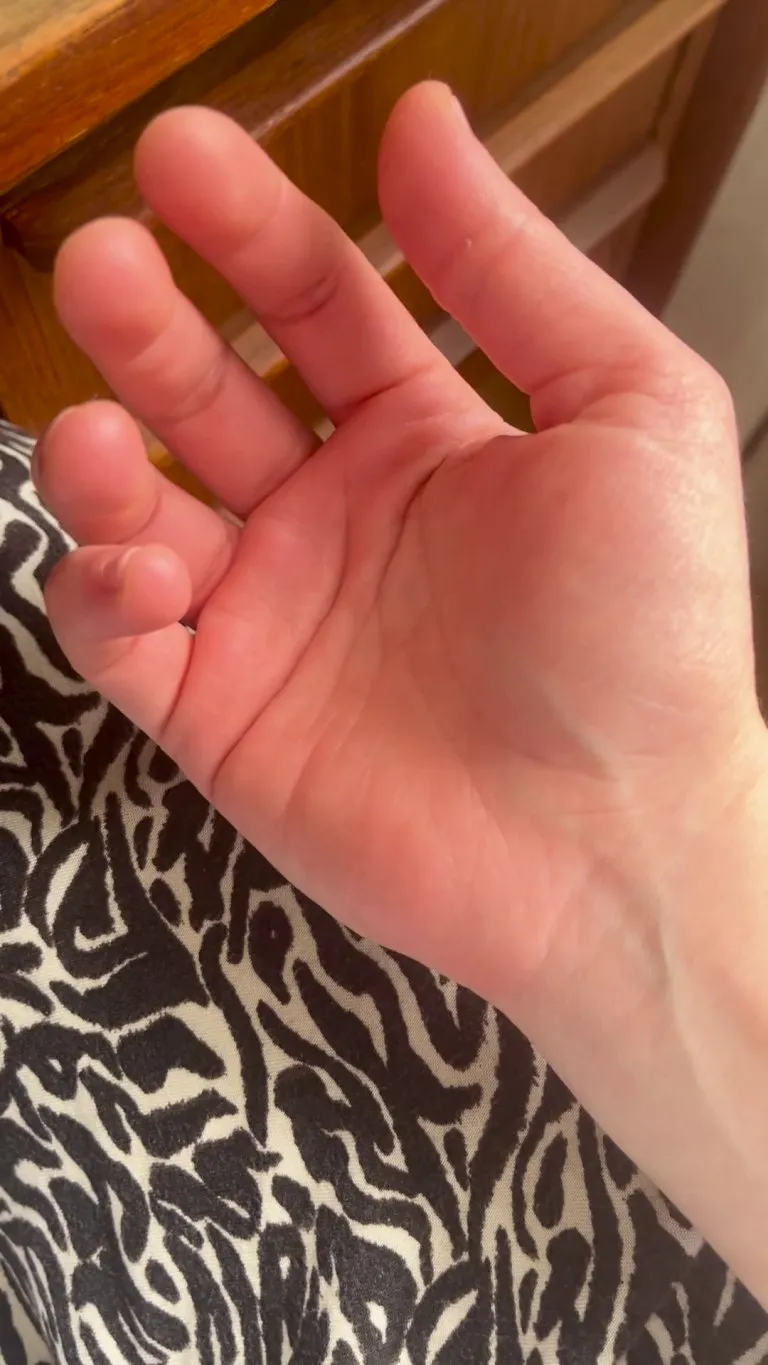 My hand starts twitching at 1:45 pm every other day