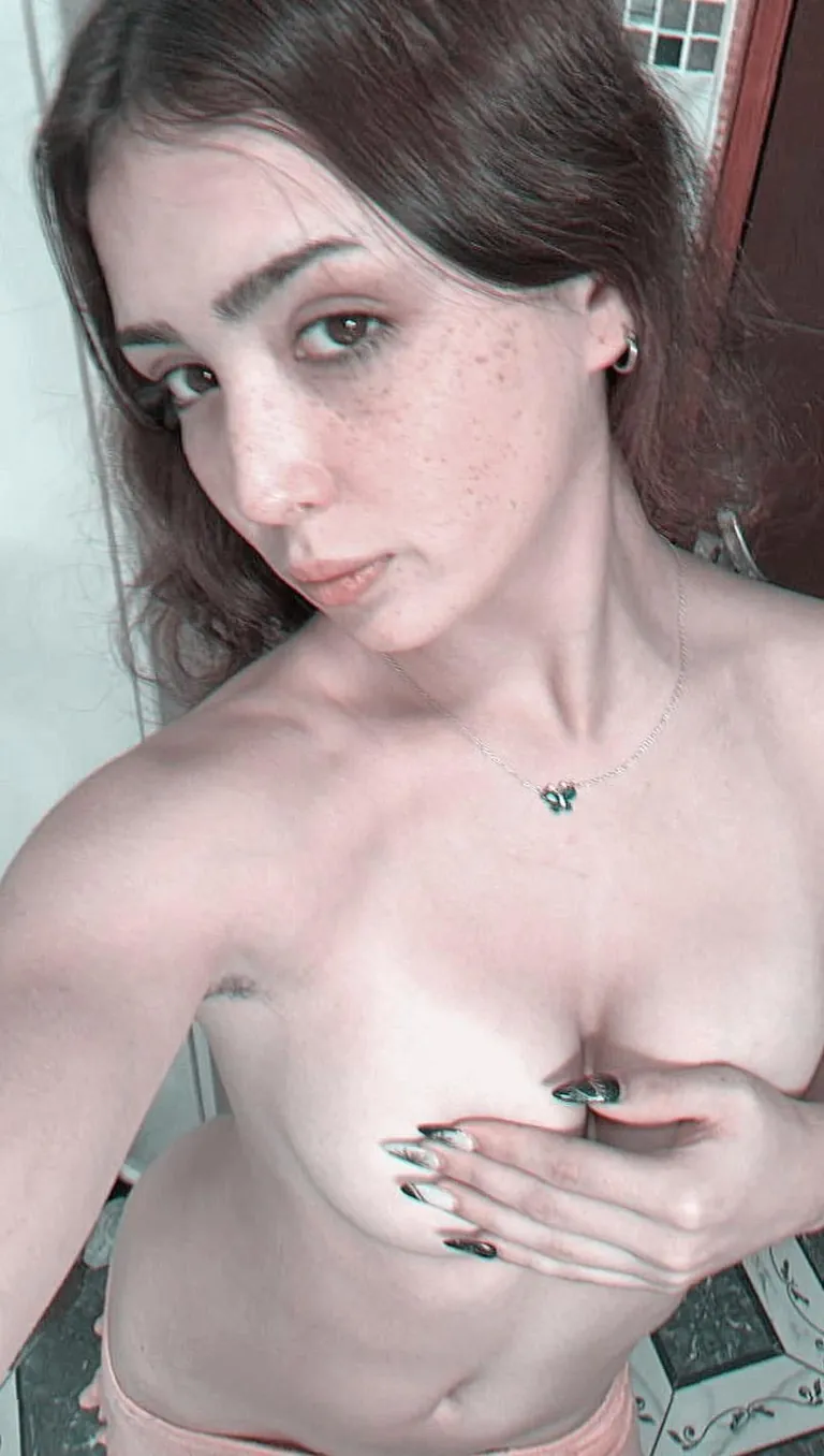 Am I hot with freckled faced F18