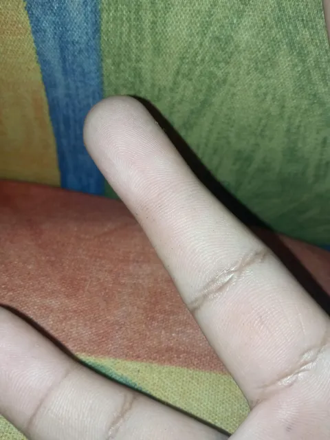 I'm missing a line on my finger 
