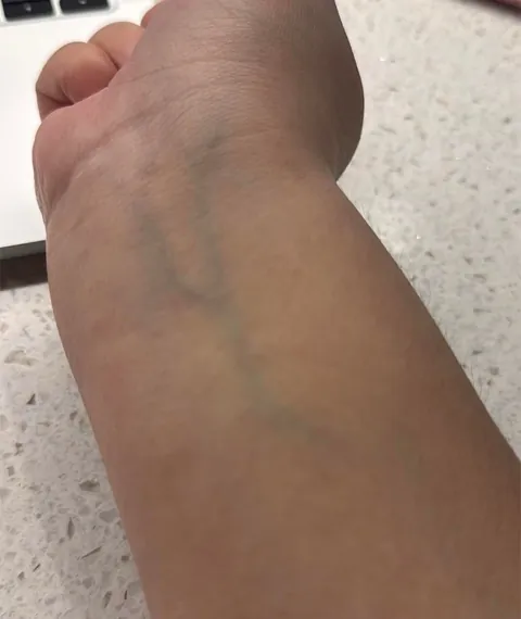 Please help. What’s my undertone?