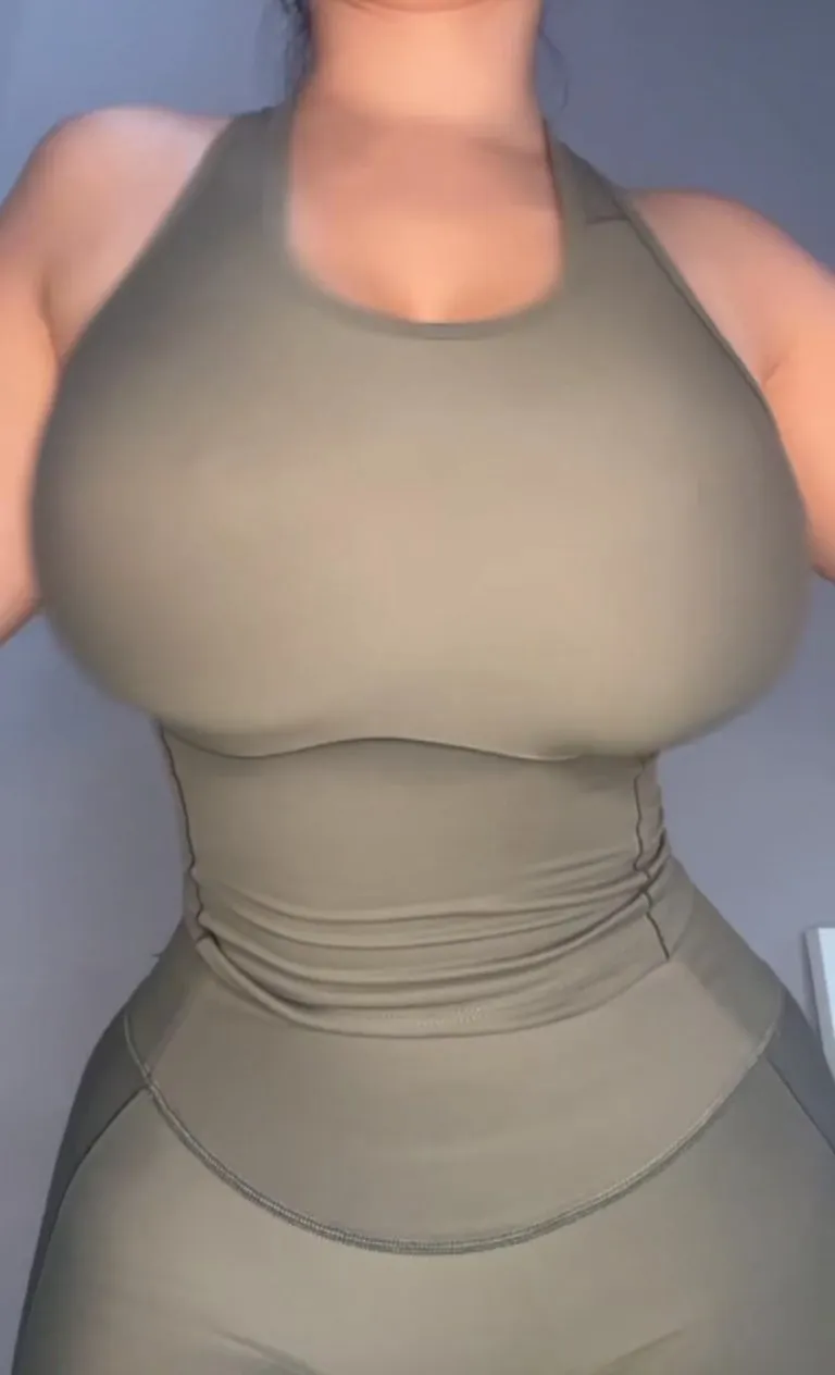 Massive mammaries