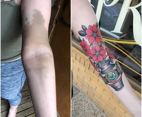 Before and after, covering an iron stain. Done by Nic at Capricorn Body art in nudawading, Victoria, Australia.