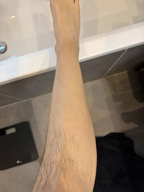 My lower legs don’t grow any hair