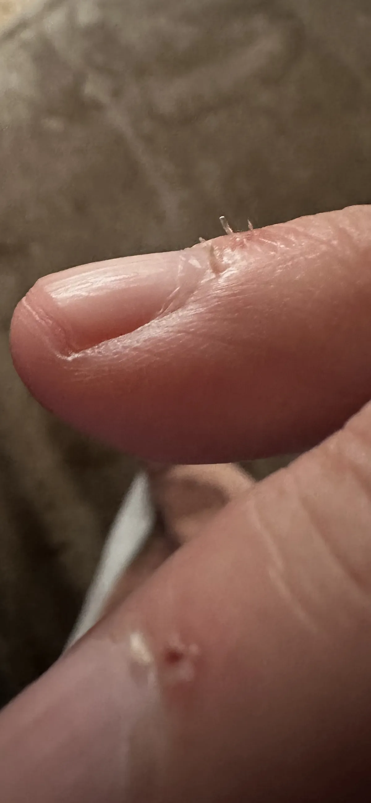 Every time you put your hand in your pocket or you’re under the covers in bed and these bastards make skin-to-cloth contact. Stupid cuticles.