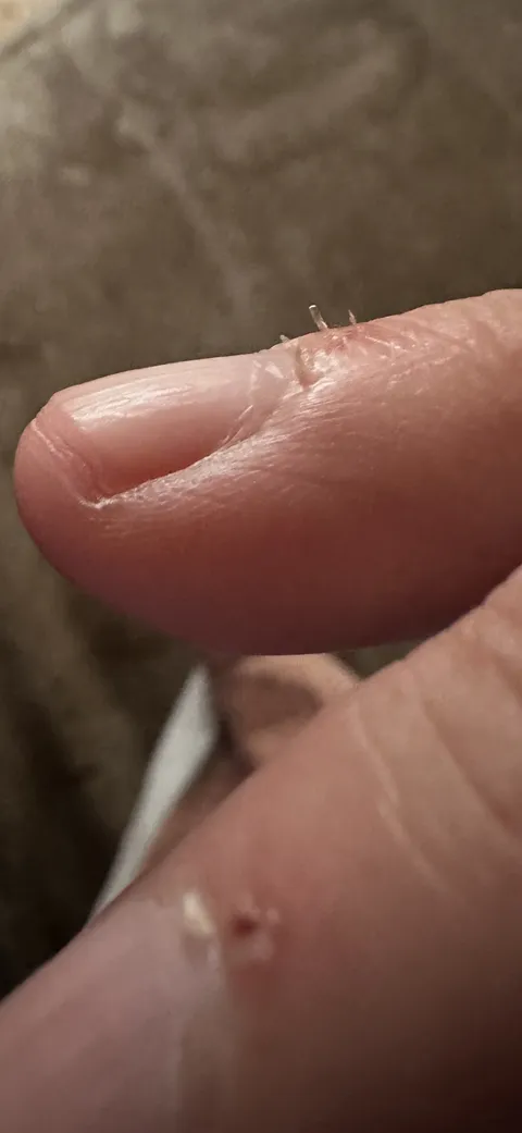 Every time you put your hand in your pocket or you’re under the covers in bed and these bastards make skin-to-cloth contact. Stupid cuticles.