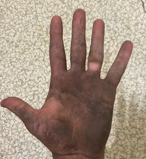 Anyone else Team No Gloves?