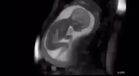 Clear MRI image shows baby in the womb Good thing we don't remember being in there it looks cramped but fascinating