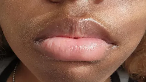 literally what do i do about my lip line????
