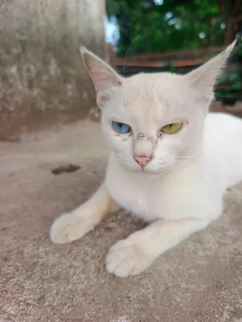 Heterochromia