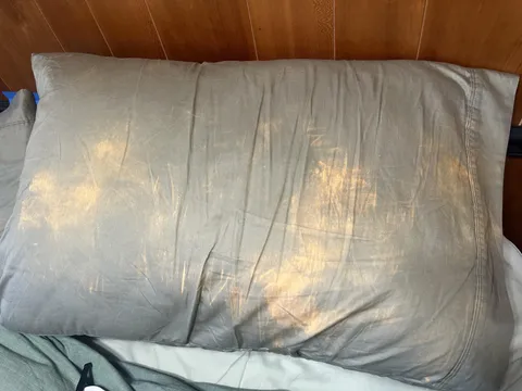 My face ruins my pillow cases