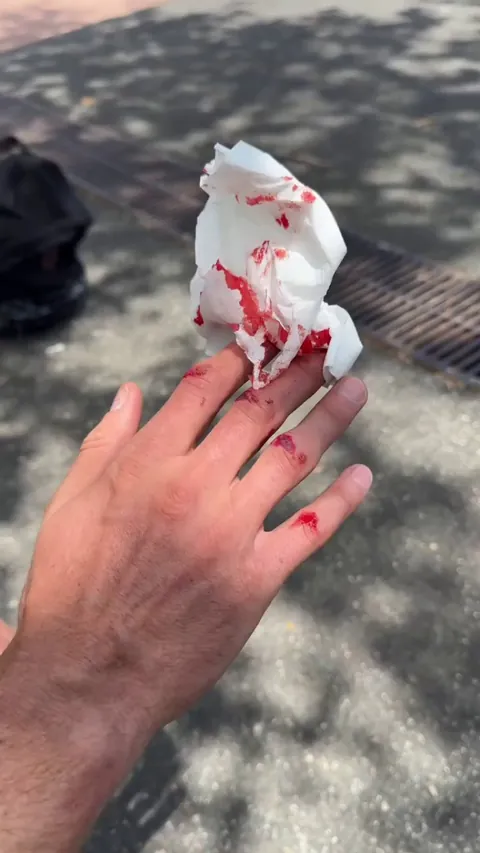 Madars Apse Does A Handstand