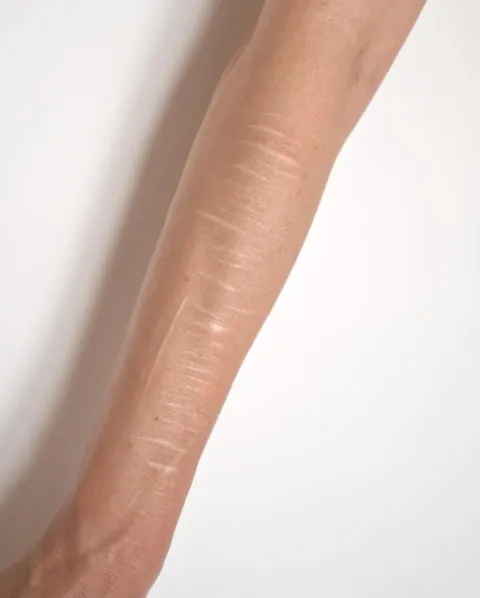 Scar tattoo cover ups (by me @karolinaszymanska_tattoo from Poland) 🌸