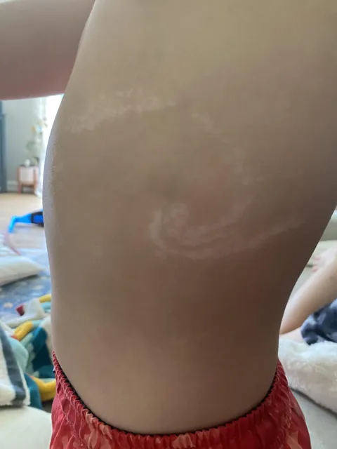 My son has a hidden birthmark of a wave that's only visible when he's tan