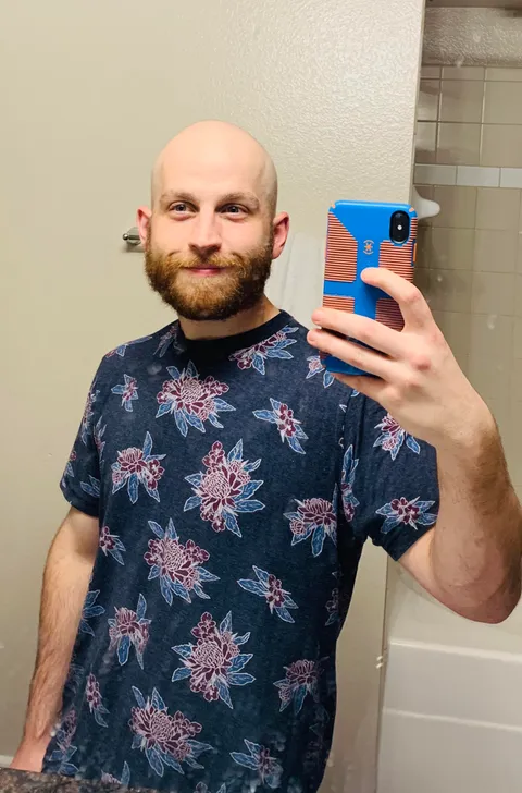 Balding has caused me so much depression. So I went bald.