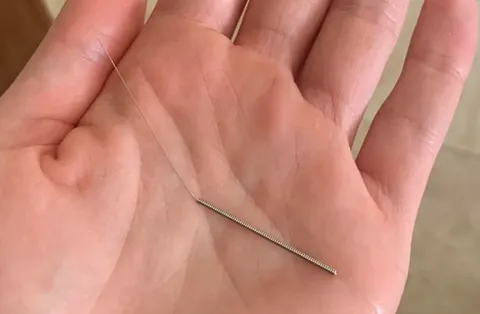 I was recommended this acupuncturist who’s suppose to be great, but after a very uncomfortable drive home, I pulled out a full needle from my ass cheek.