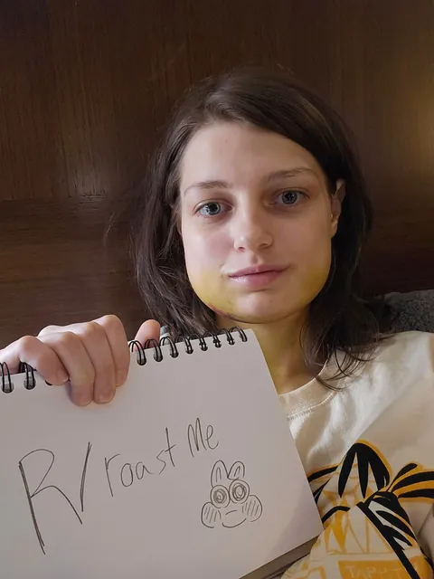 19, I had jaw surgery and thought this would be a funny one. Second photo is maybe an hour after post op!