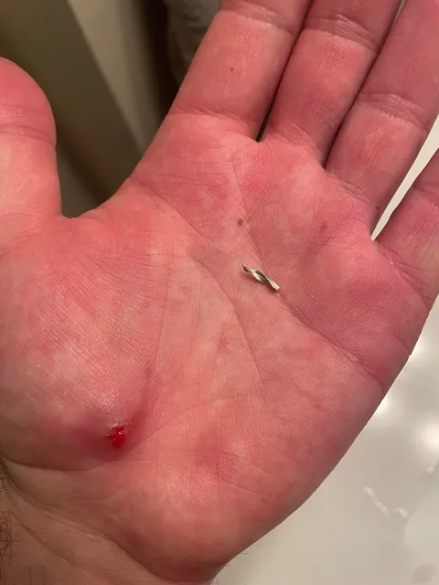 I had this piece of aluminum in my hand since December 10th.  After many attempts, I finally got it out today. 