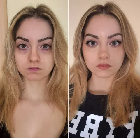 Full face before and after