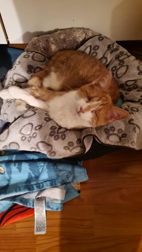 Born with no EyeBalls (anophthalmia)... My Beauty Queen