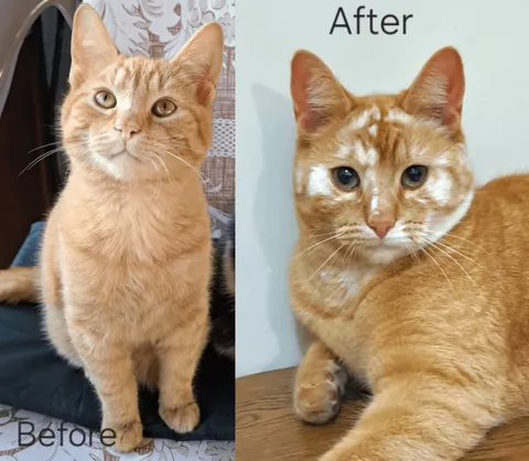 Before VS After vitiligo