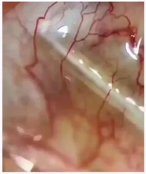 Live view of blood flow in real time.