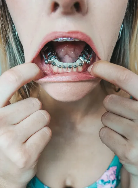 I have a crazy lisp with my new herbs appliance in