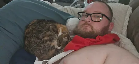 She wont leave my side since i shatteredcmy elbow