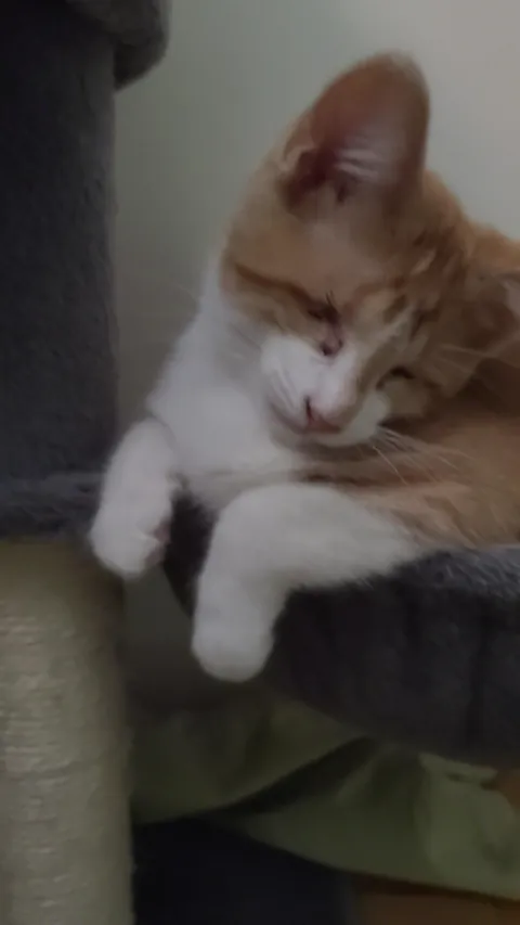 Born with no EyeBalls (anophthalmia)... My Beauty Queen